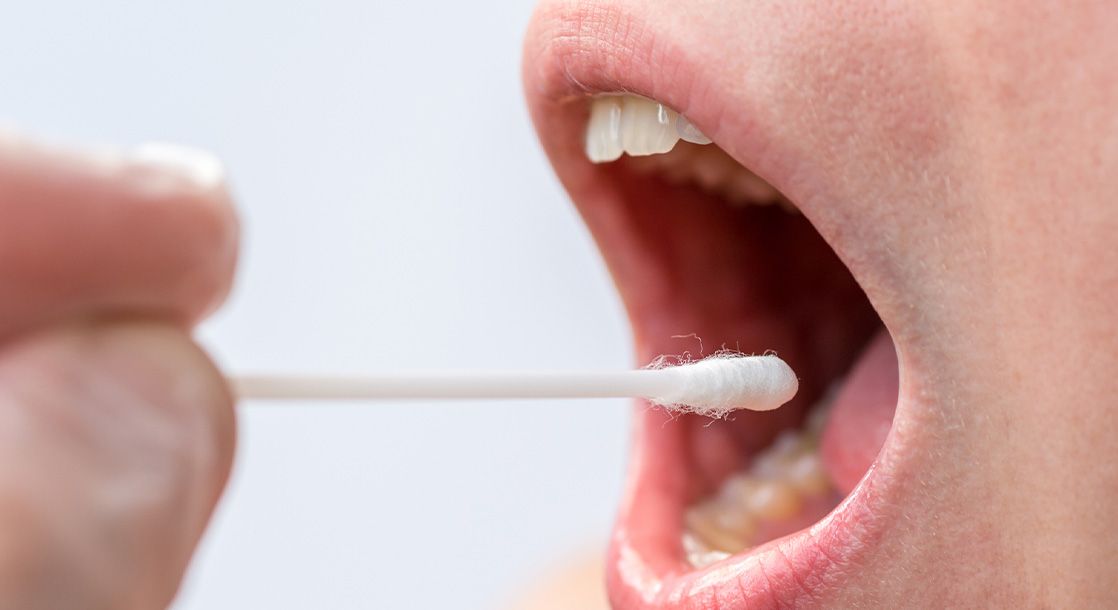 Weed 101 How to Beat a Mouth Swab Drug Test